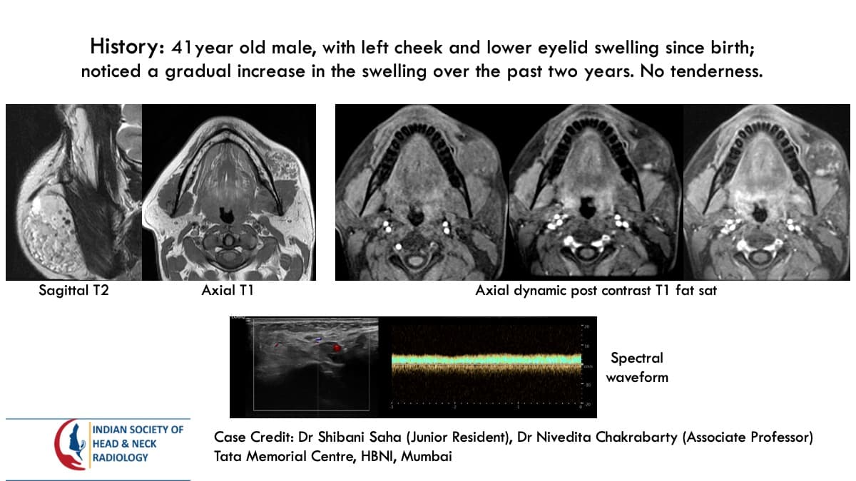 Case 151 — slide 1 of 3