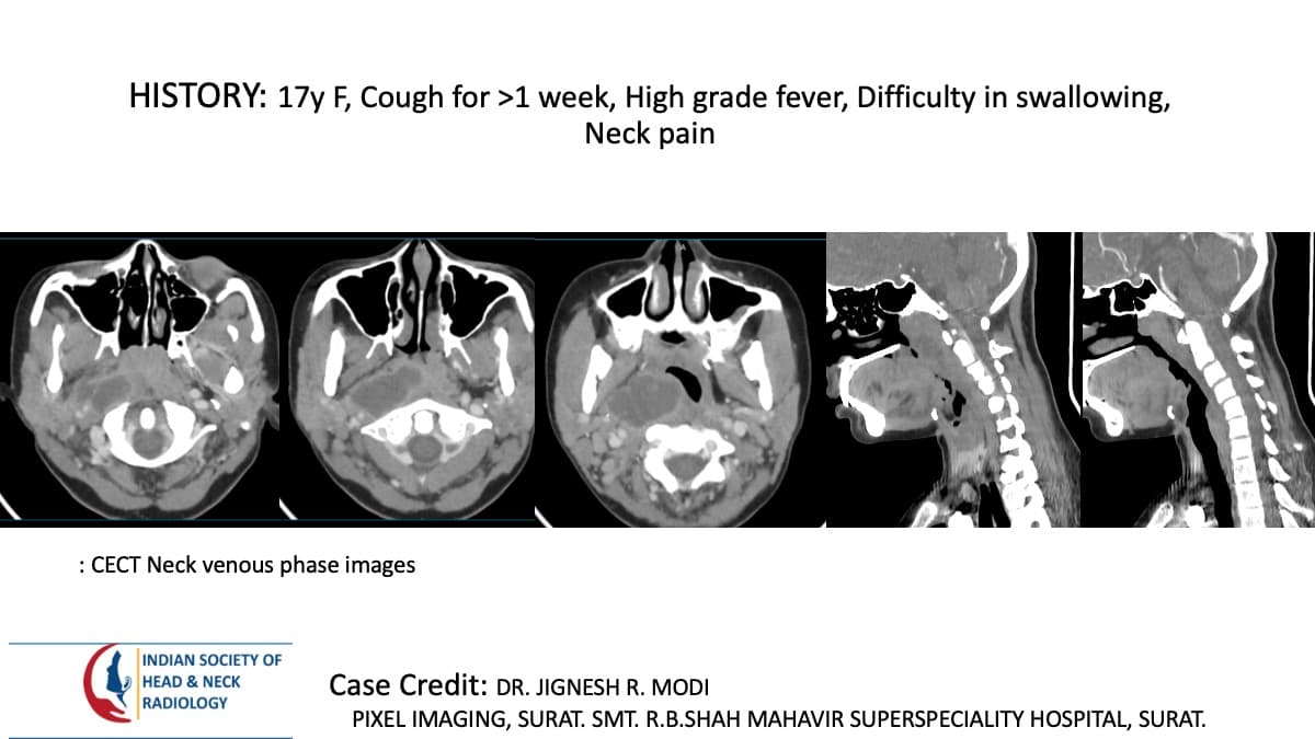 Case 153 — slide 1 of 5