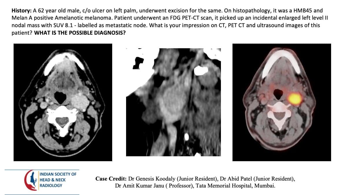 Case 155 — slide 1 of 6