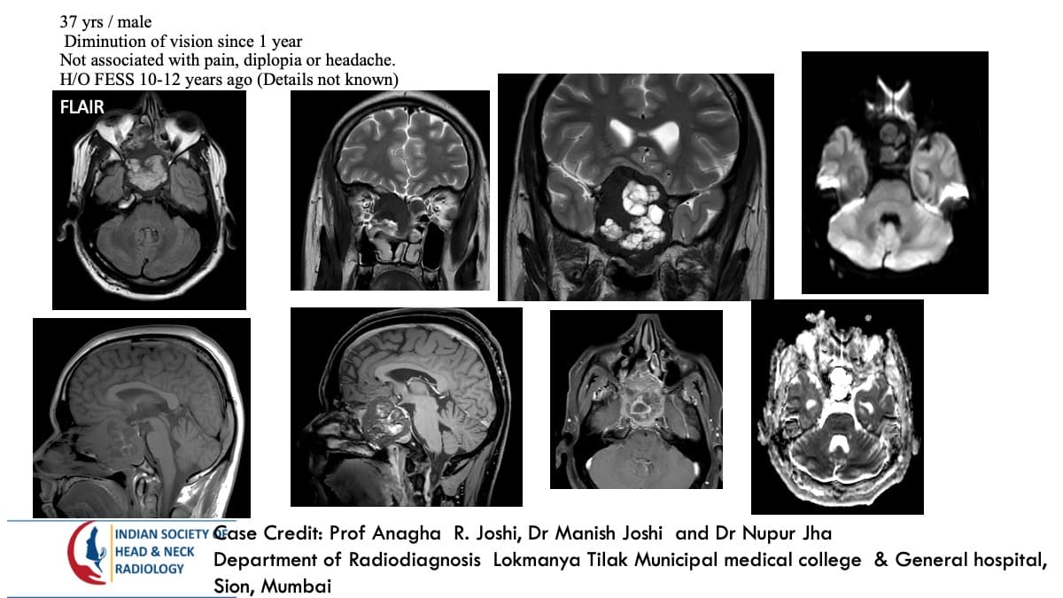 Case 161 — slide 1 of 3
