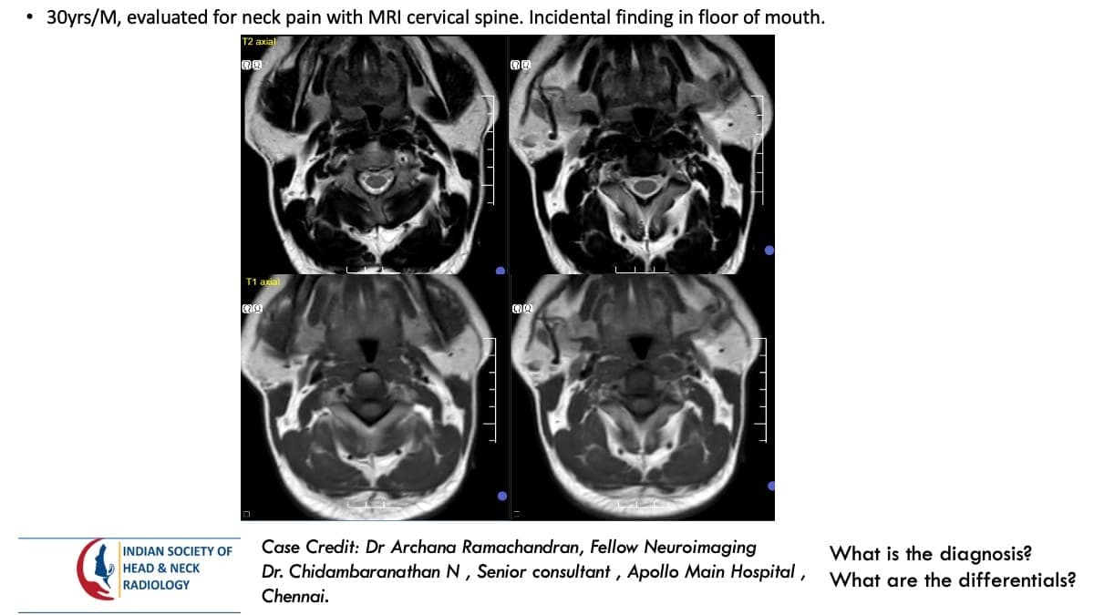 Case 162 — slide 1 of 5