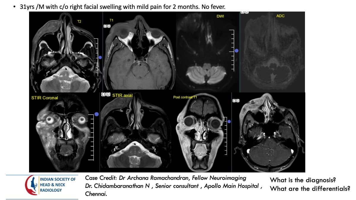 Case 167 — slide 1 of 4