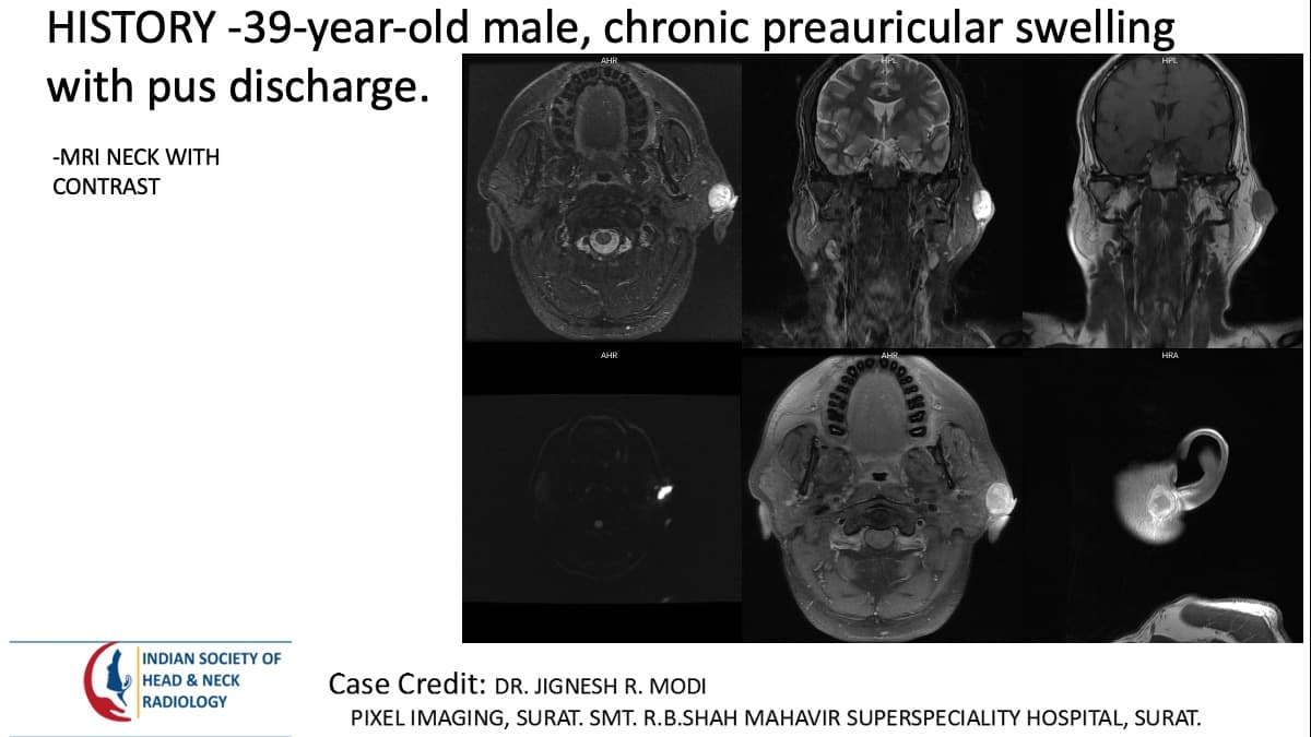 Case 168 — slide 1 of 5