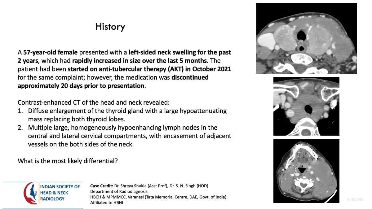 Case 175 — slide 1 of 3