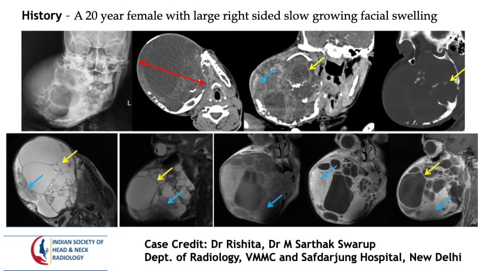 Case 190 — slide 1 of 3