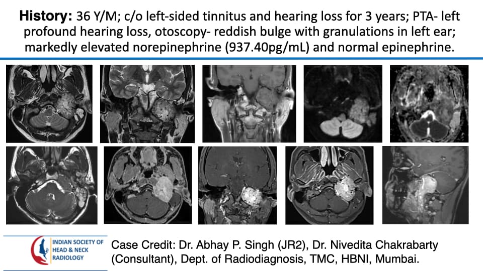 Case 193 — slide 1 of 5