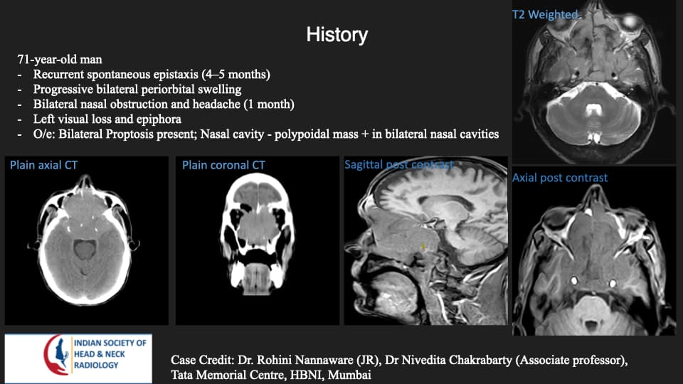 Case 199 — slide 1 of 3