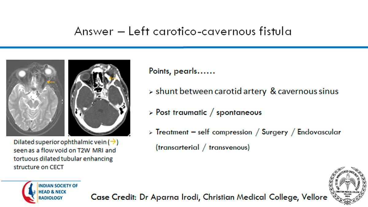Case 7 thumbnail 2