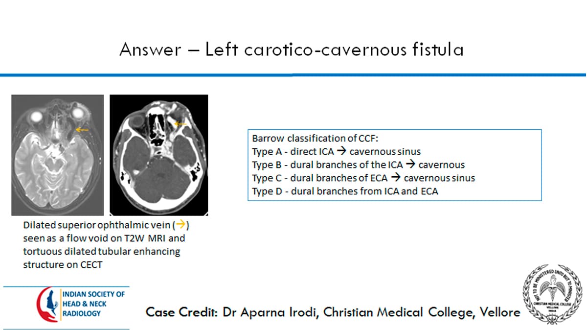 Case 7 thumbnail 3