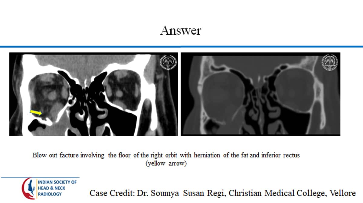 Case 23 thumbnail 2