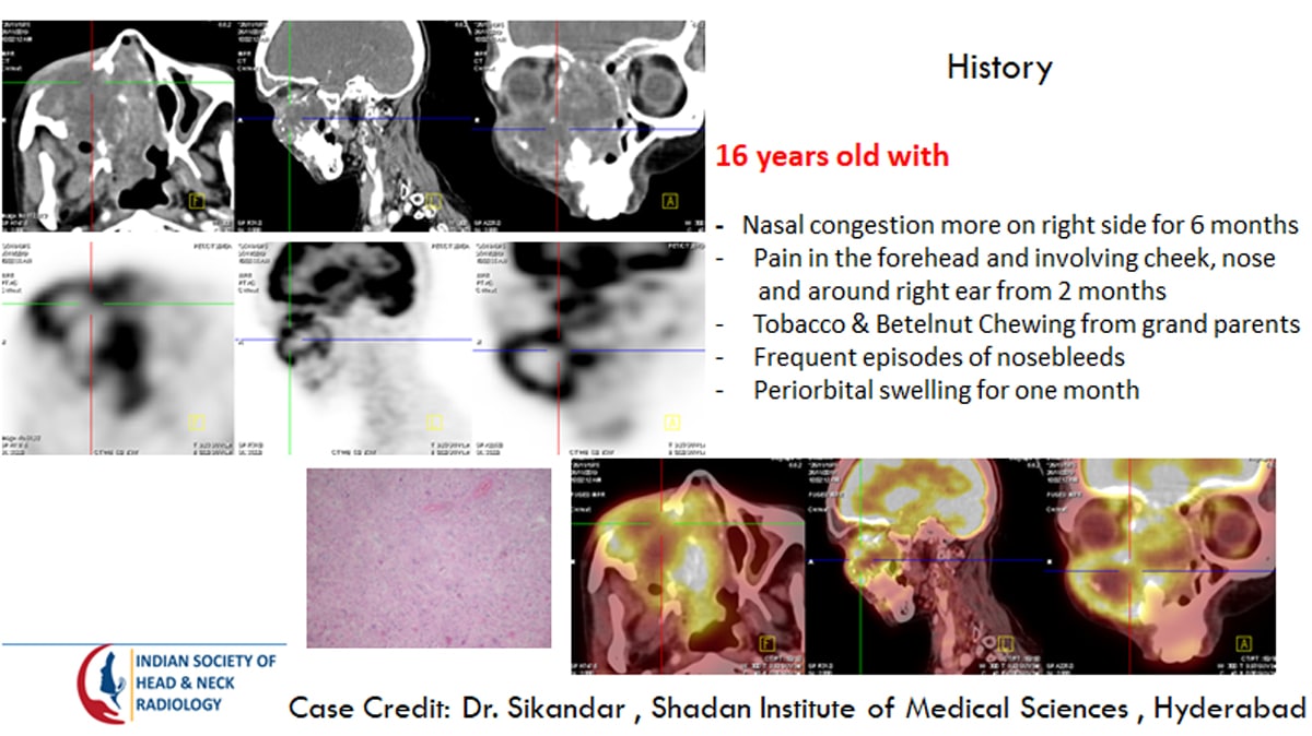 Case 25