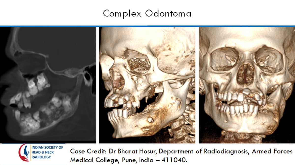 Case 28 Slide 3 – 18 August Answer