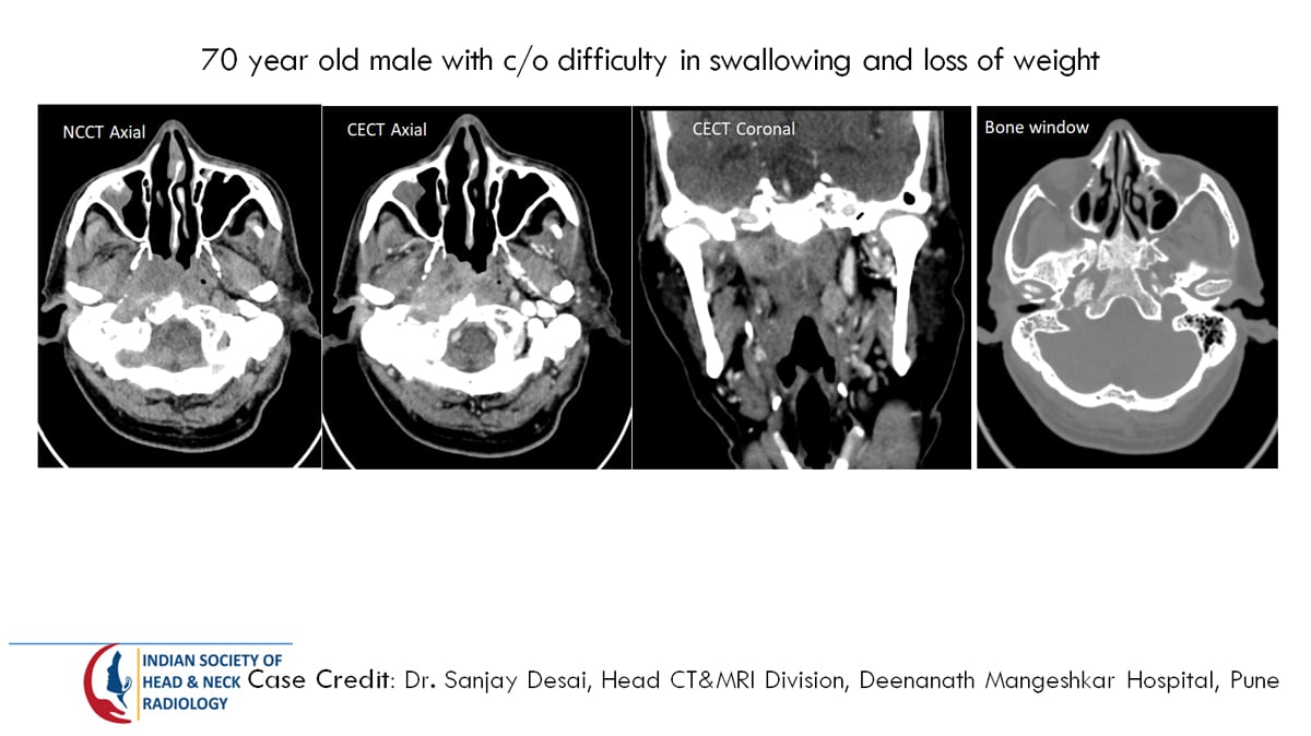 Case 30 Slide 1 – 31 August Answer