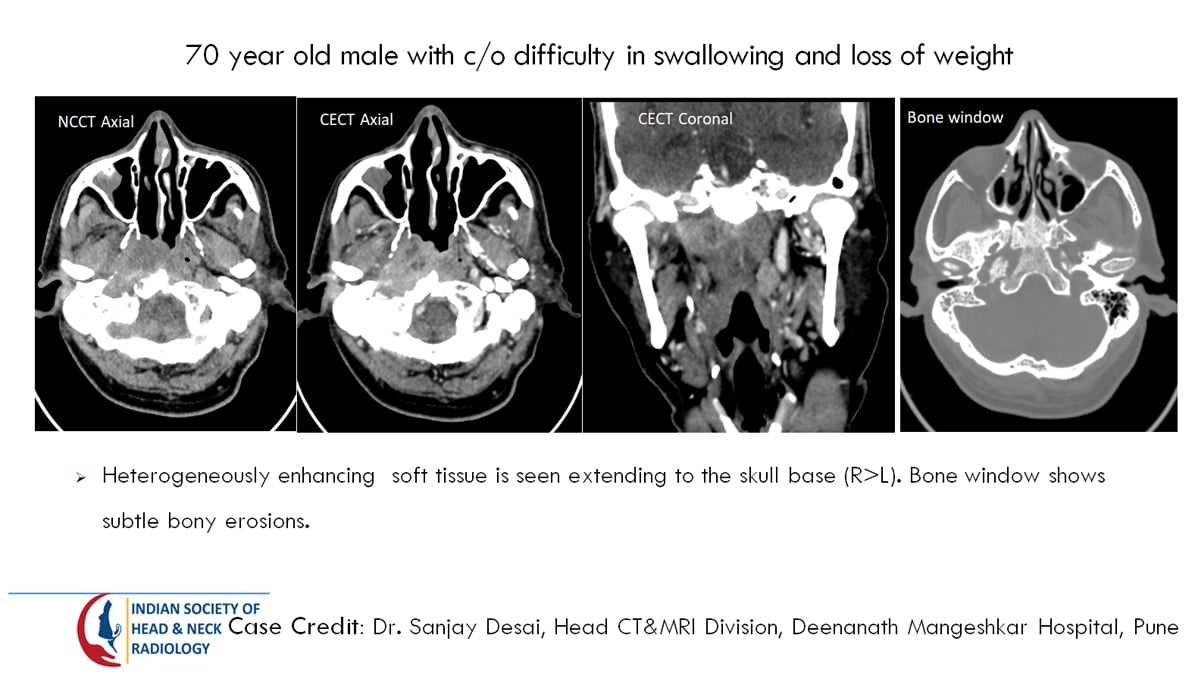 Case 30 Slide 2 – 31 August Answer