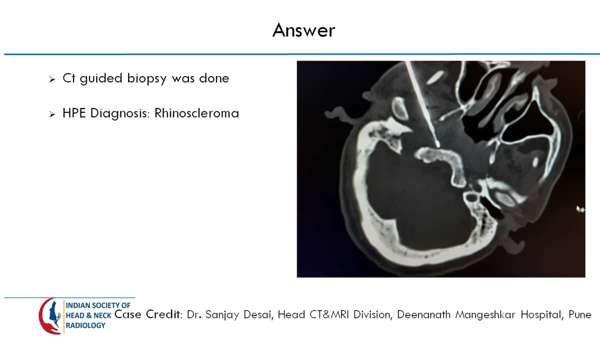 Case 30 Slide 3 – 31 August Answer