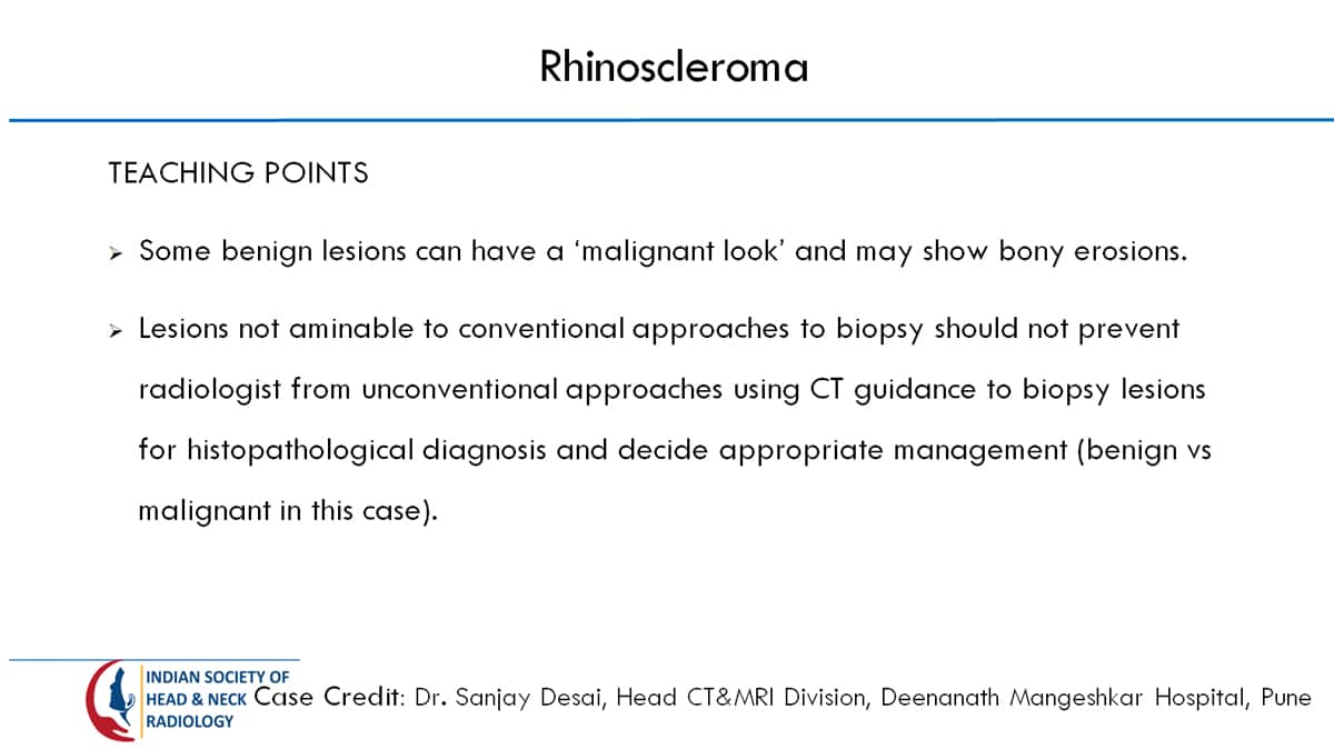 Case 30 Slide 4 – 31 August Answer