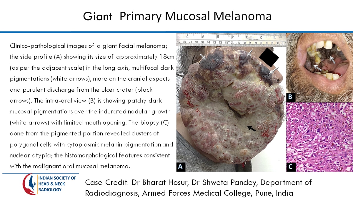 Case 59 thumbnail 3