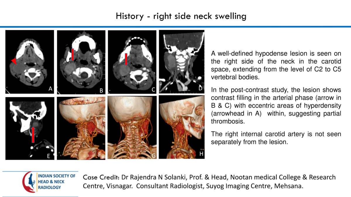 Case 76 thumbnail 2