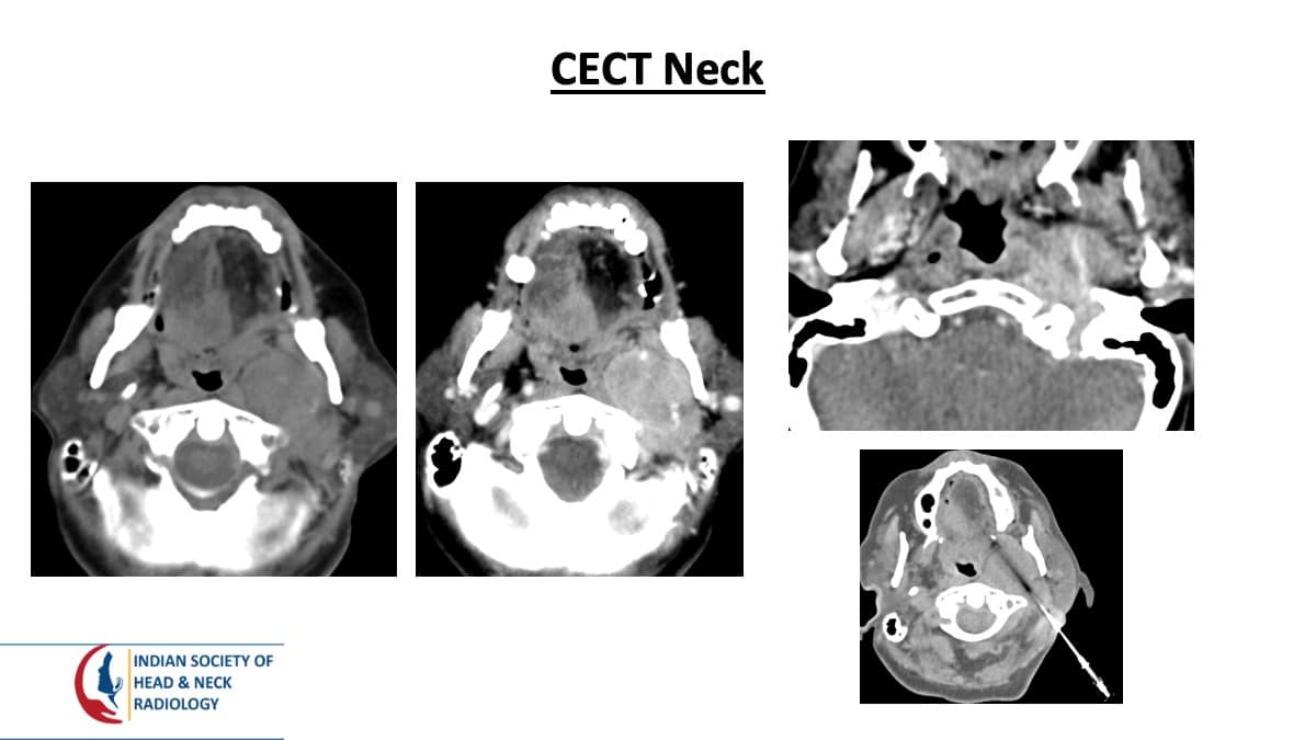 Case 109 thumbnail 3