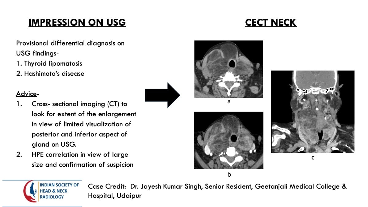 Case 112 thumbnail 3