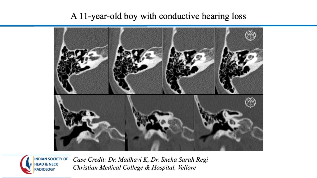 Case 128