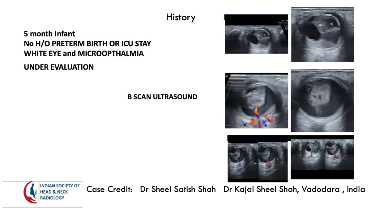 Case 133