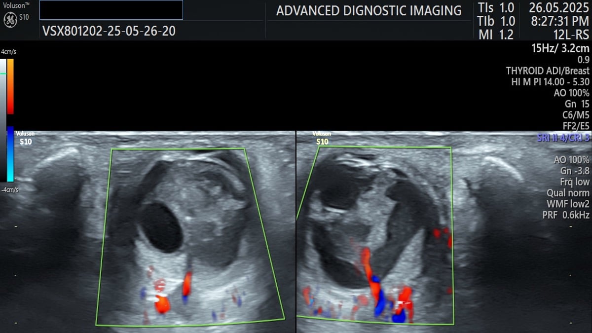 Case 133 thumbnail 3