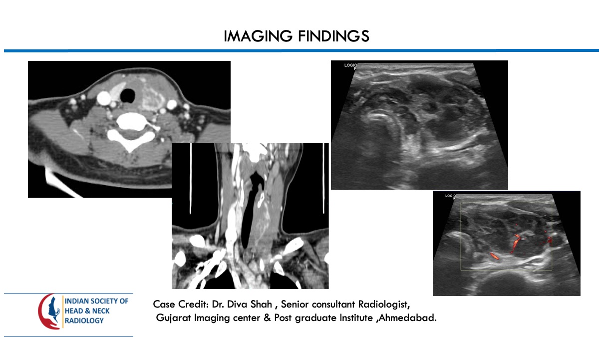 Case 138 thumbnail 2