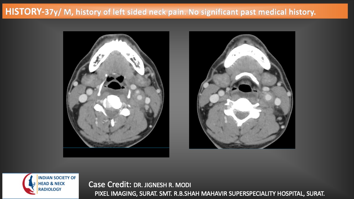 Case 154