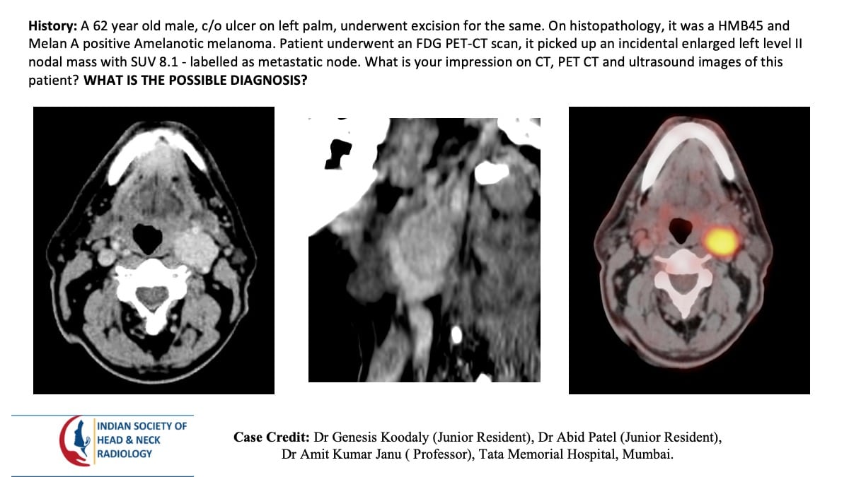 Case 155 — slide 1 of 6