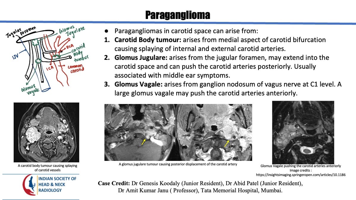 Case 155 thumbnail 5