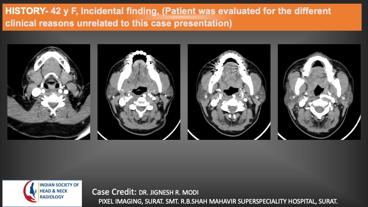 Case 156 — slide 1 of 6