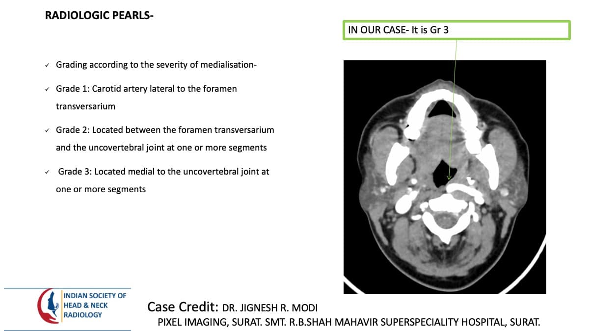 Case 156 thumbnail 3