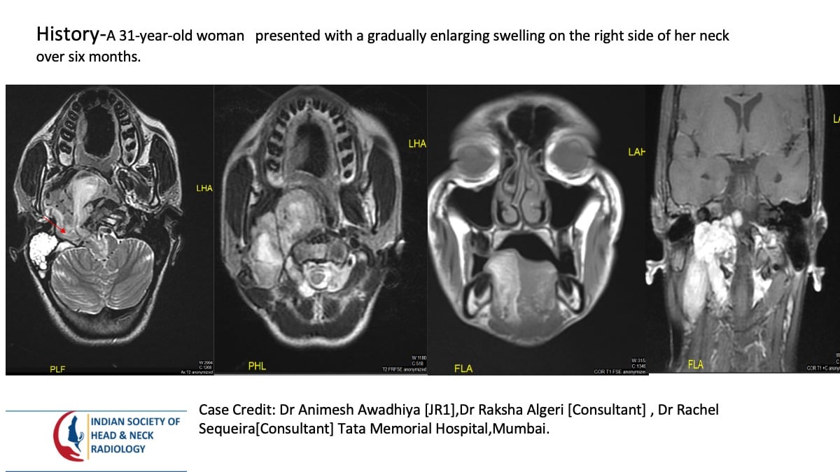 Case 158 — slide 1 of 4