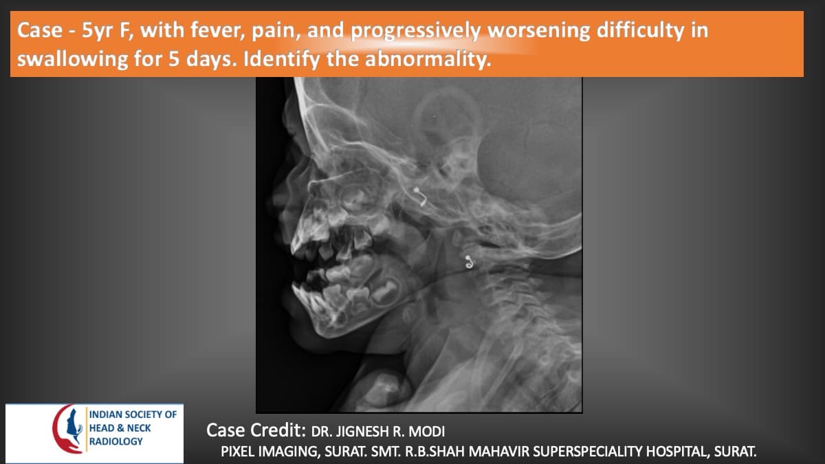 Case 159 — slide 1 of 5