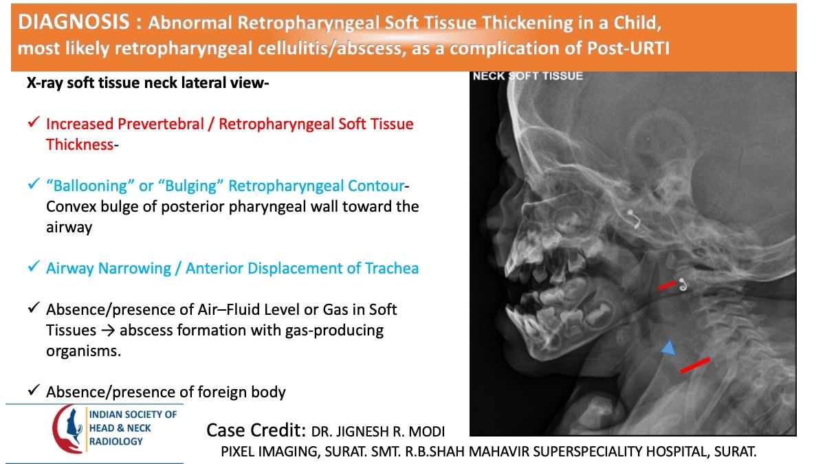 Case 159 thumbnail 2