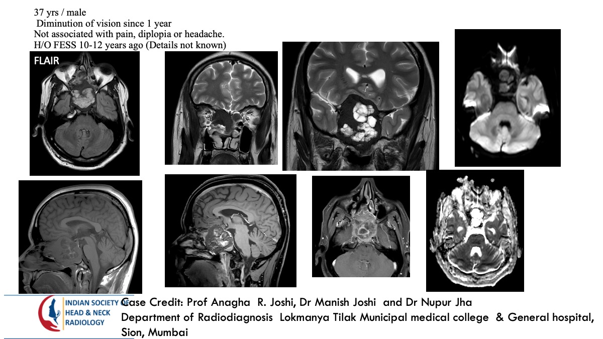 Case 161 — slide 1 of 3