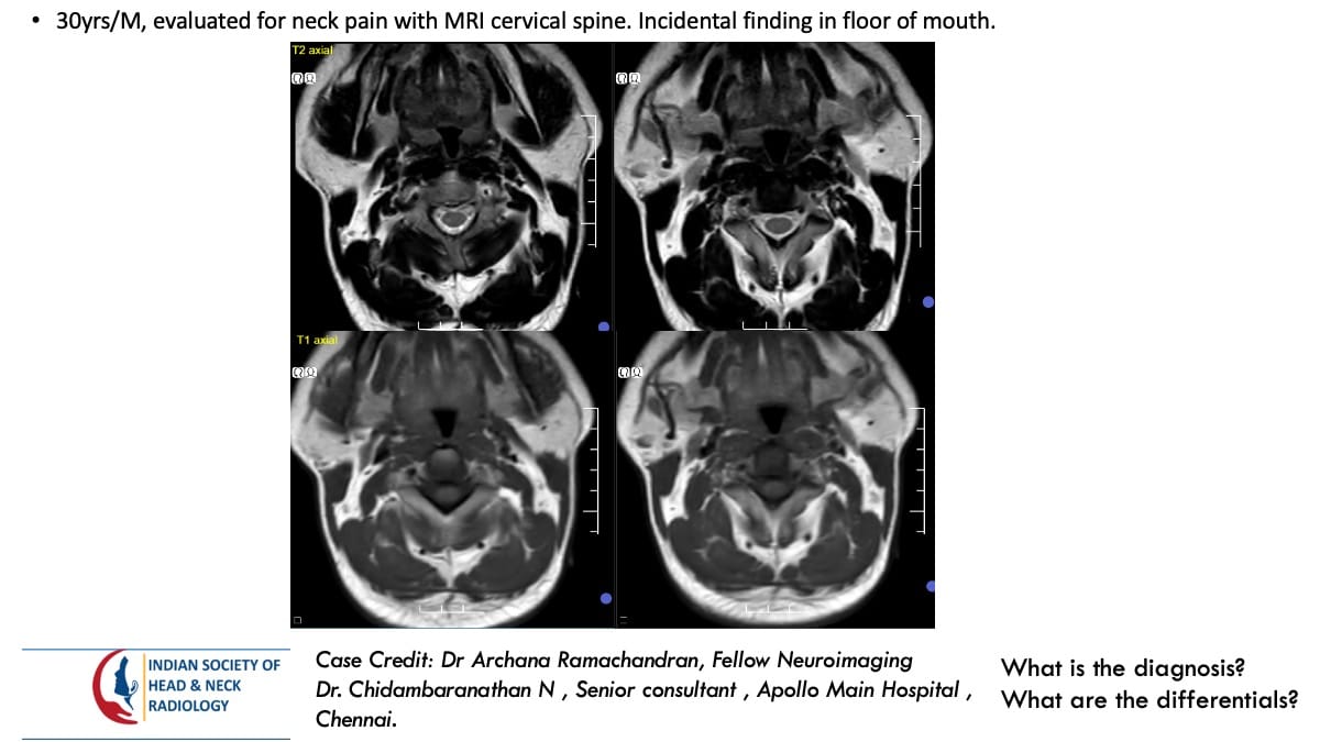Case 162 — slide 1 of 5