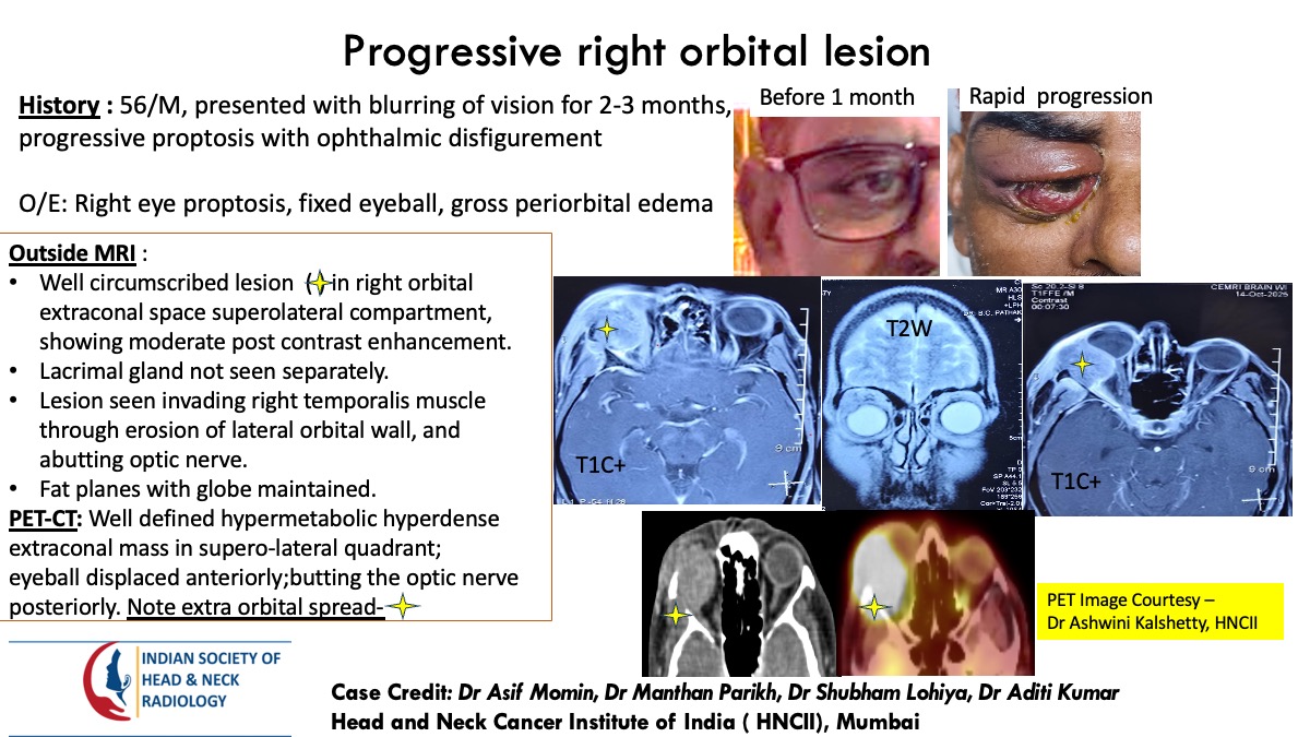 Case 163 — slide 1 of 3