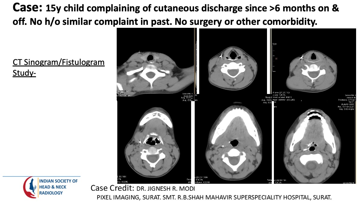 Case 164 — slide 1 of 7