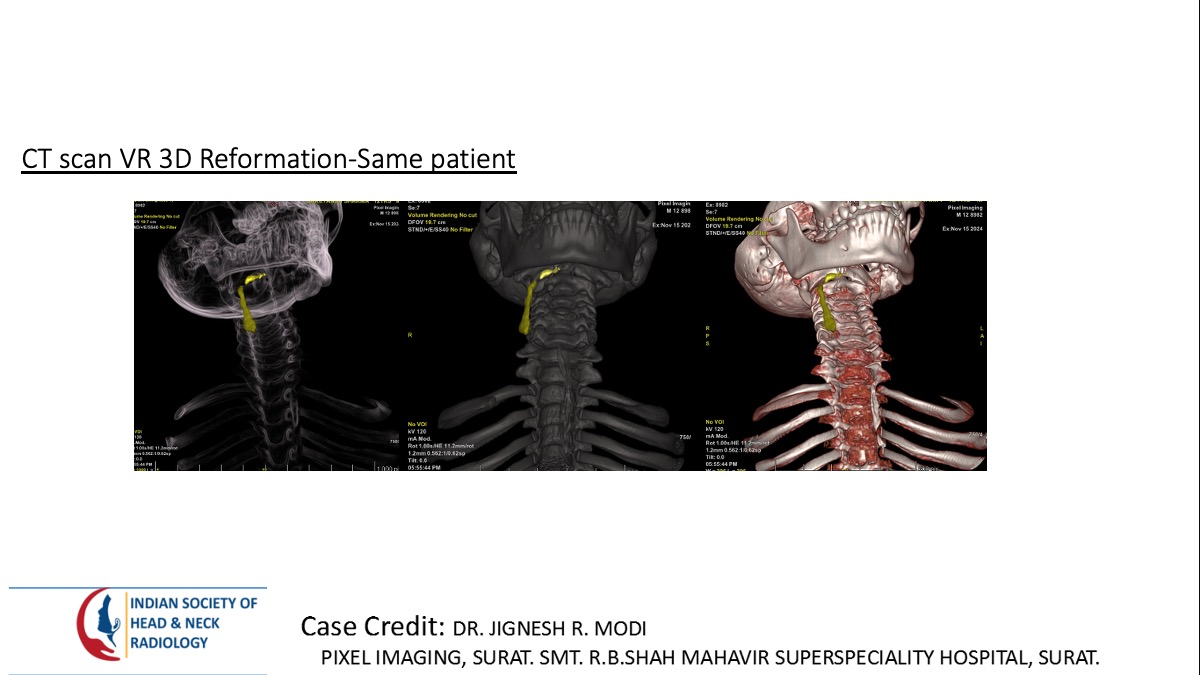 Case 164 thumbnail 3