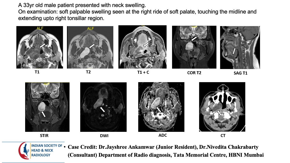 Case 165 — slide 1 of 3