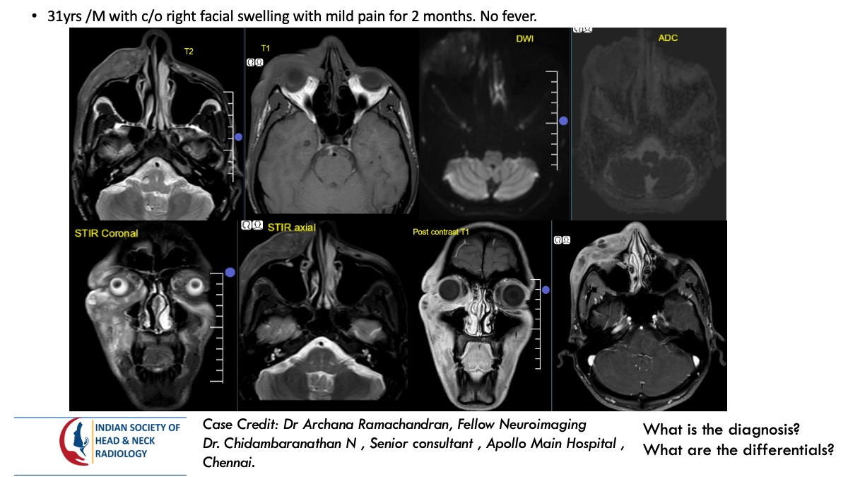 Case 167 — slide 1 of 4