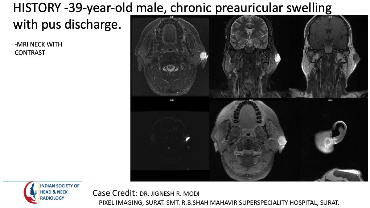 Case 168 — slide 1 of 5