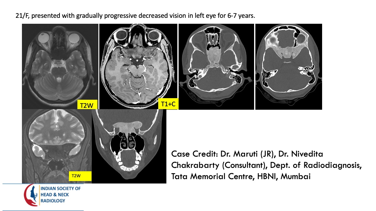 Case 169 — slide 1 of 2