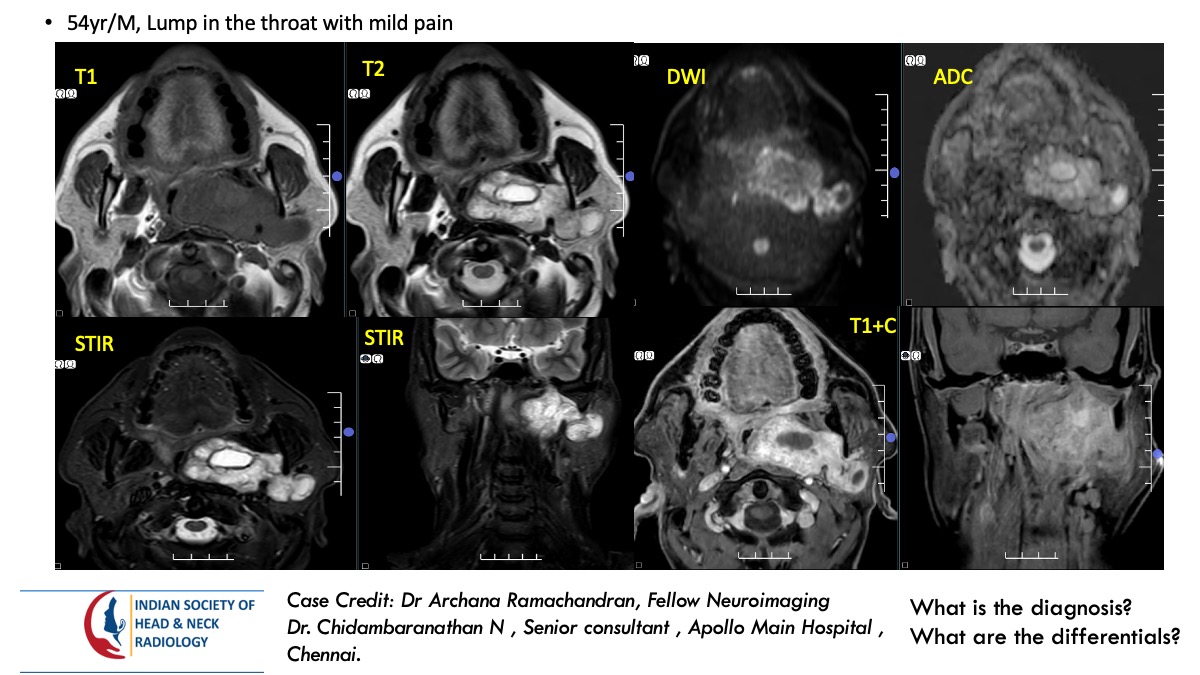 Case 171 — slide 1 of 5