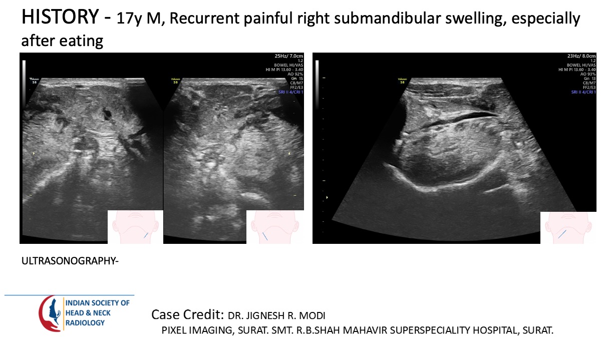 Case 172 — slide 1 of 5