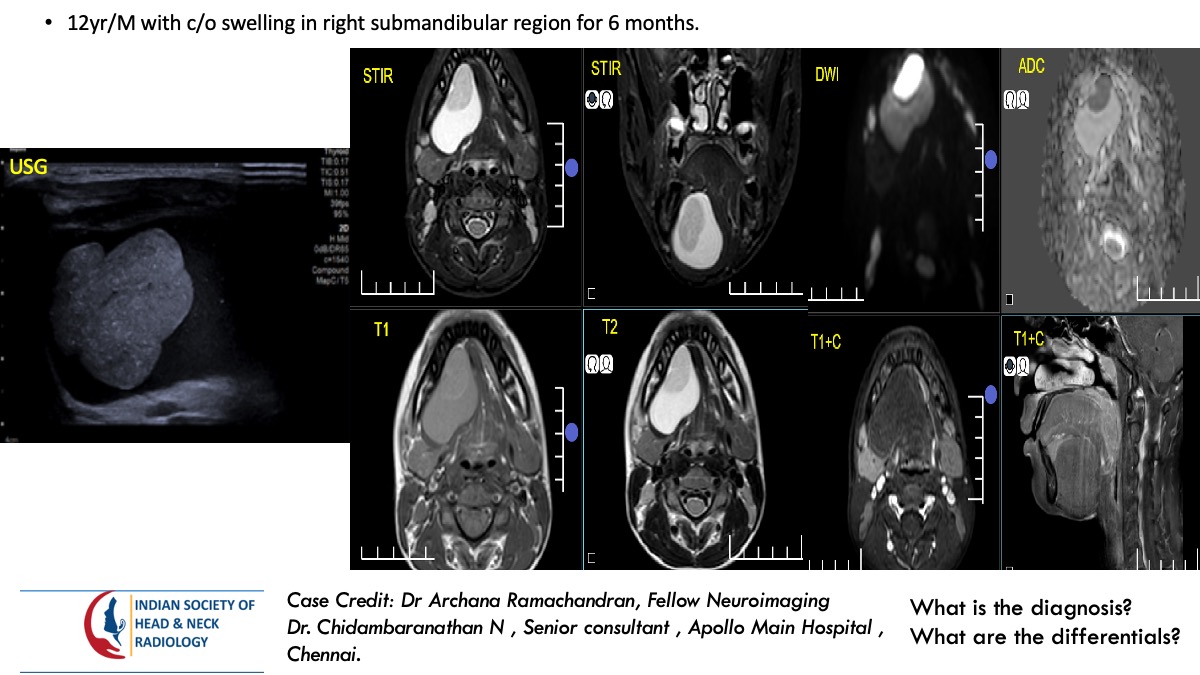 Case 173 — slide 1 of 4