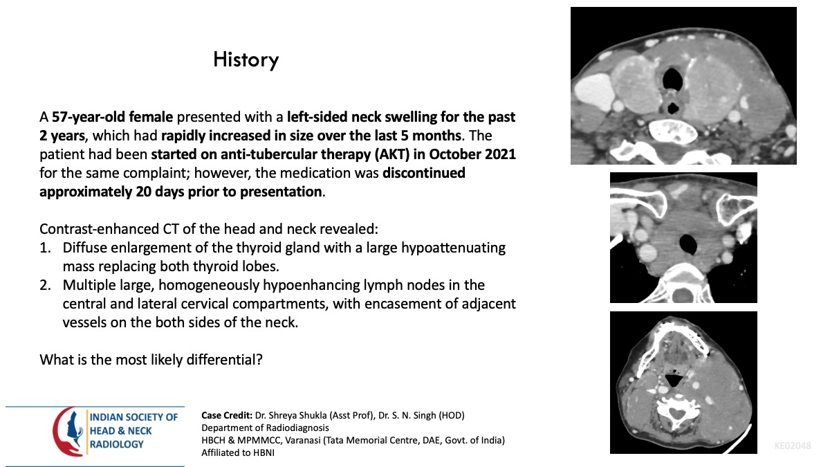 Case 175 — slide 1 of 3