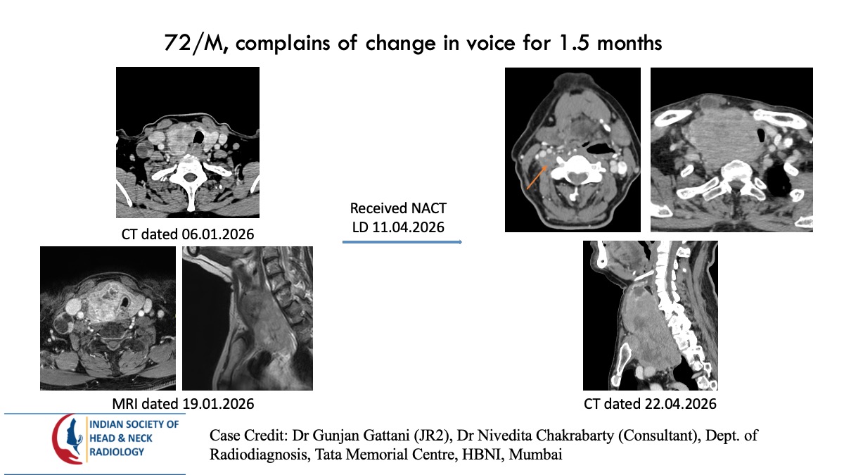 Case 180 — slide 1 of 3